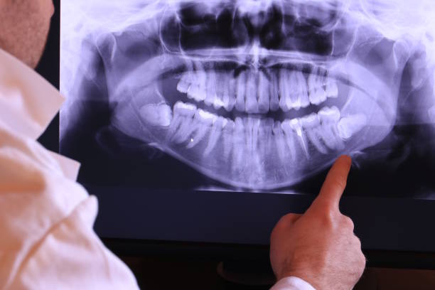 Best Emergency Dentist for Knocked-Out Tooth in Strasburg, CO